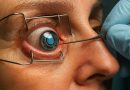 O invenție medicală redă vederea persoanelor afectate de degenerescența maculară
